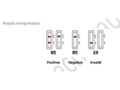 Import Diagnostic Kit for Detection of IgM Antibody to SARS-CoV- 2(Colloidal Gold) from chinese wholesale supplier and manufacturer