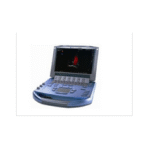 Import Hand-carried ultrasound MicroMaxx from chinese wholesale supplier and manufacturer