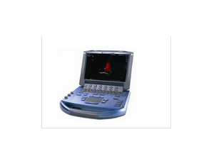 Import Hand-carried ultrasound MicroMaxx from chinese wholesale supplier and manufacturer